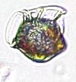 Dinophysis